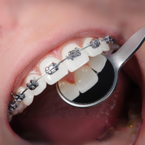 Essential Dental Care