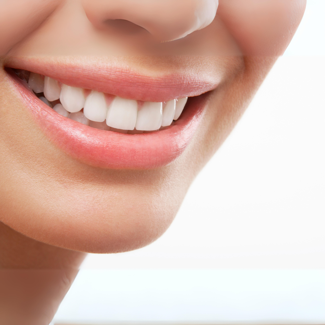 Secrets of Root canal