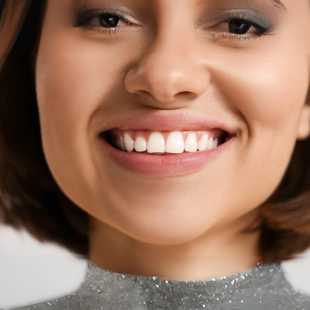 Bright Smile