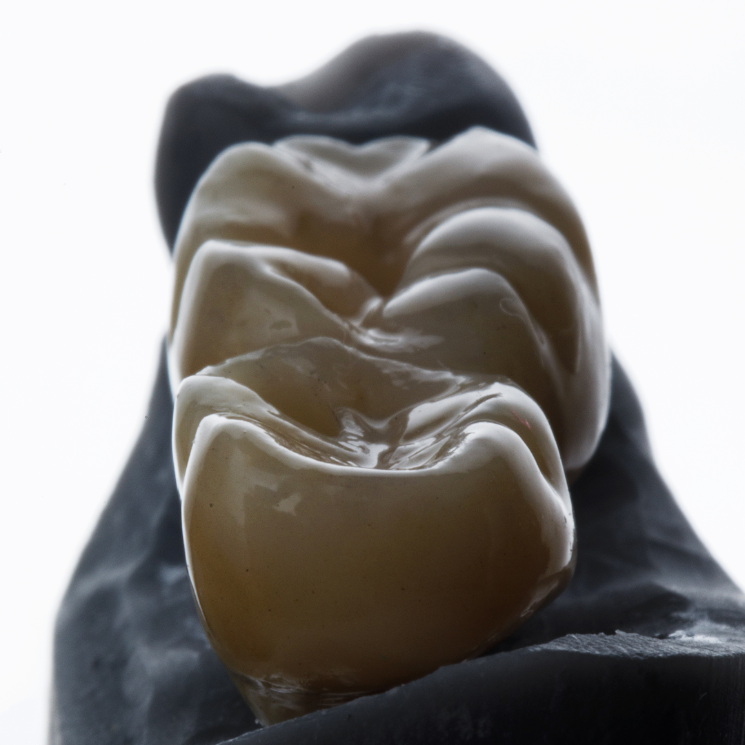 Cavities