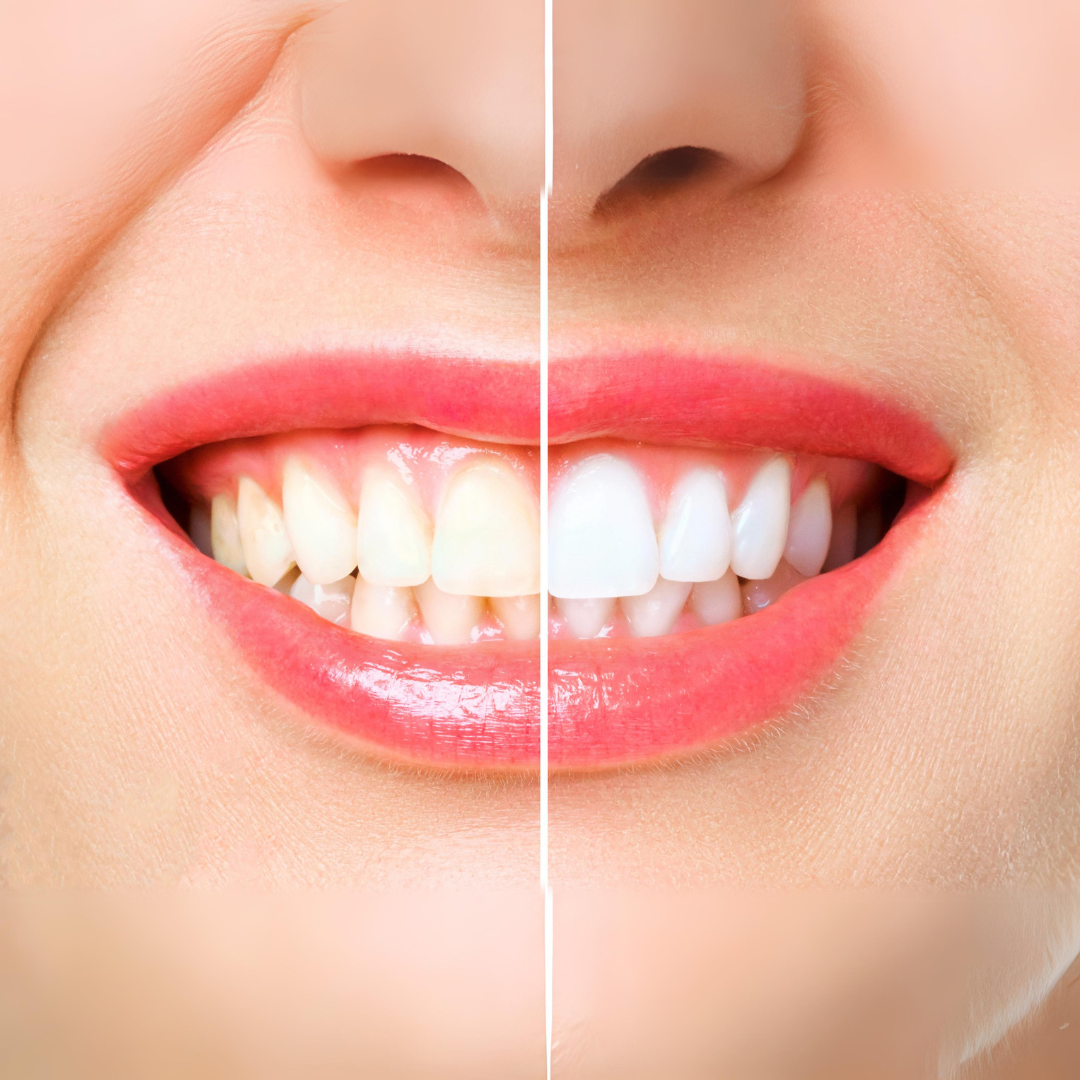 Healthy Teeth