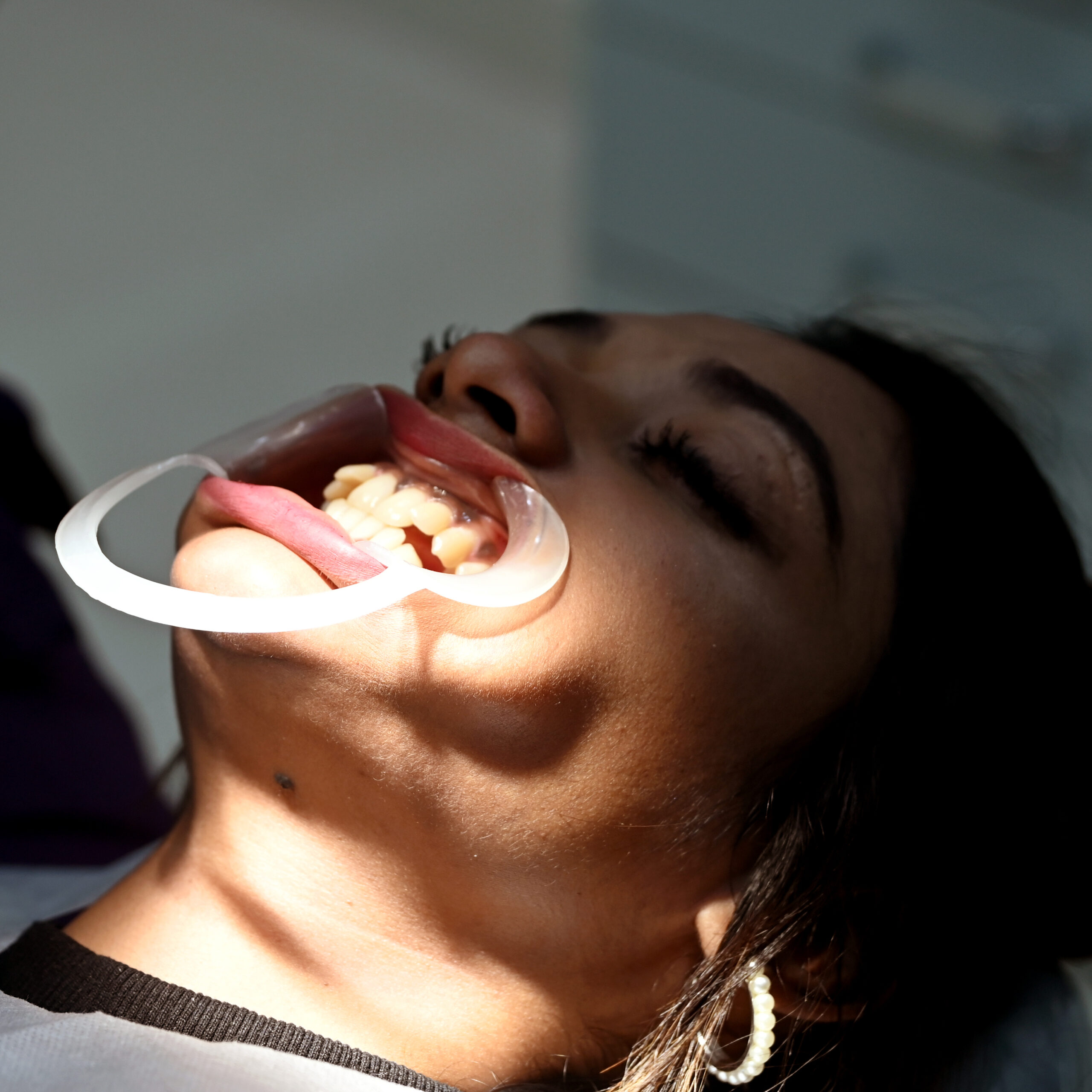 Dental care during