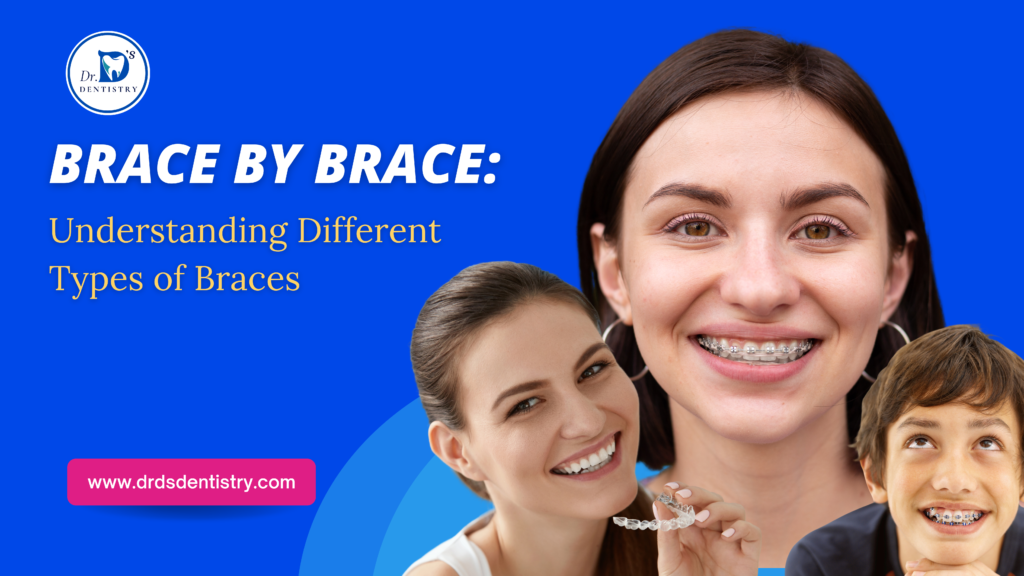 Brace By Brace: Understanding Different Types Of Braces - Dr D Dentistry